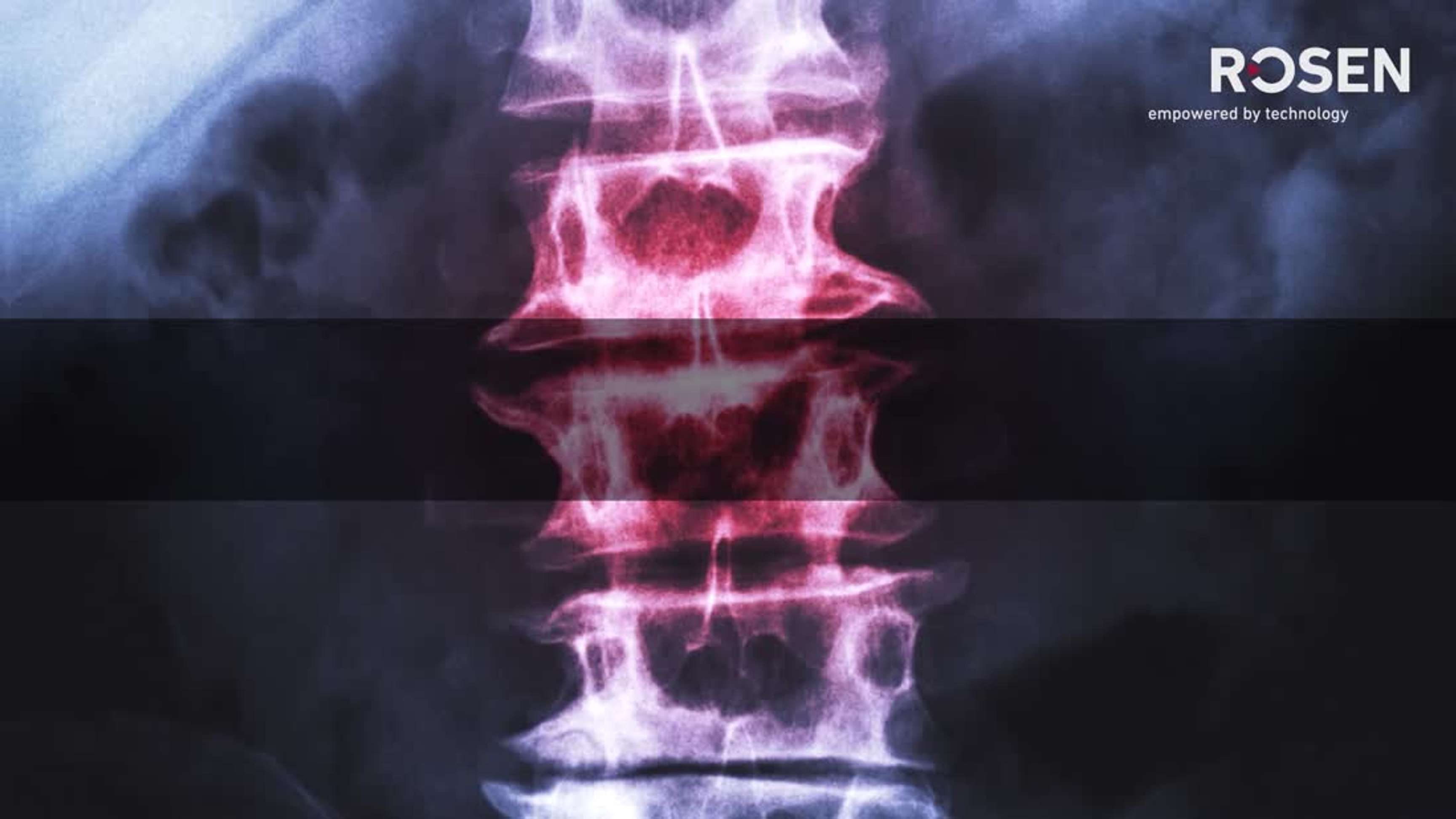 RoCorr MFL-A Ultra - In-Line Inspection Service for Metal Loss Detection and Sizing