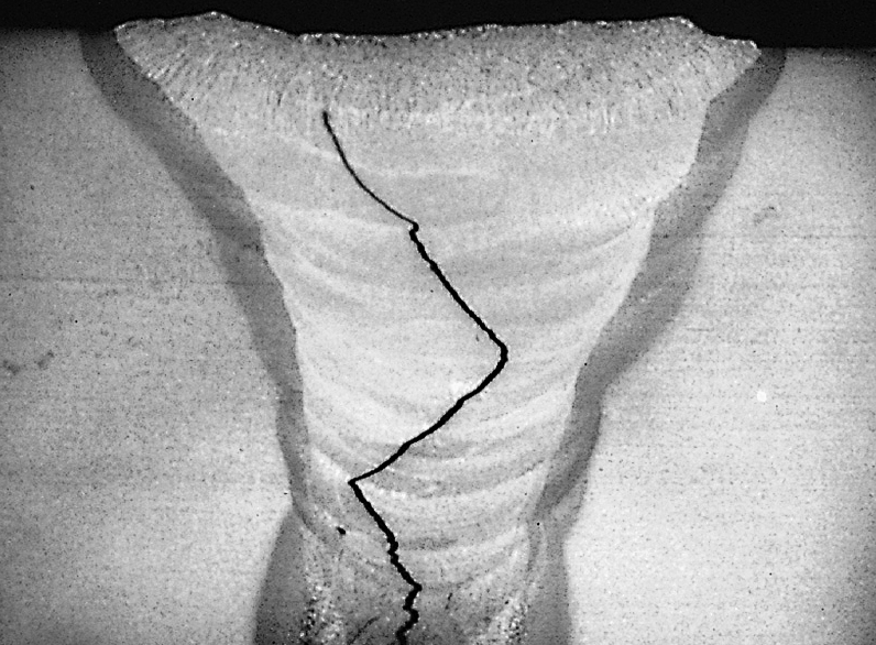 Picture of a crack in a pipeline weld.